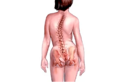 Dôvody rozvoja krčnej osteochondrózy