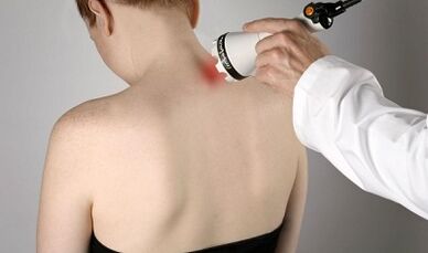 Liečba bolesti vo fyzioterapeutických postupoch krku